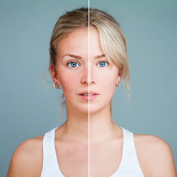 Dermastir firming facial treatment (Kopio) (Kopio) (Kopio) (Kopio) (Kopio) (Kopio)